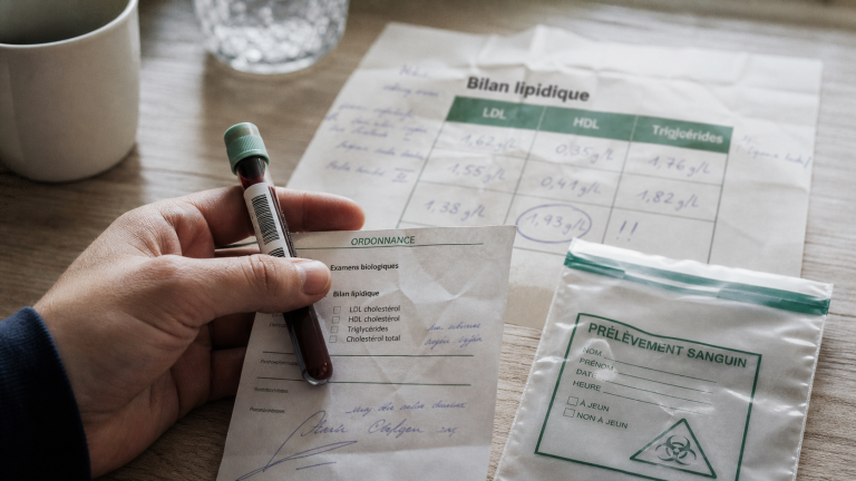 Bilan lipidique prise de sang : LDL HDL triglycérides
